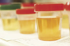 pee in a cup for a drug test